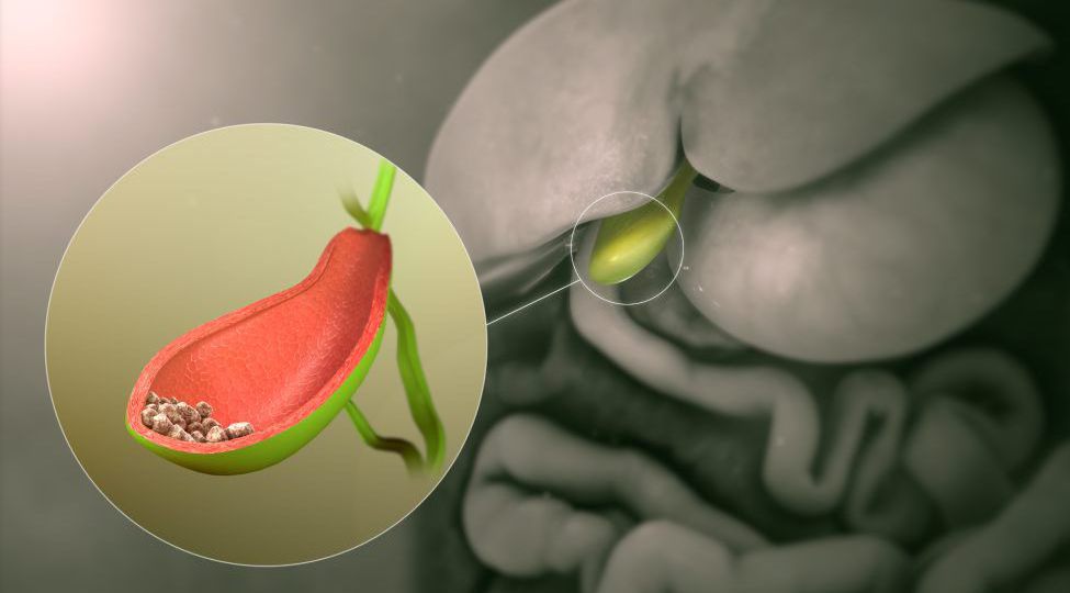 Gallbladder Cancer head