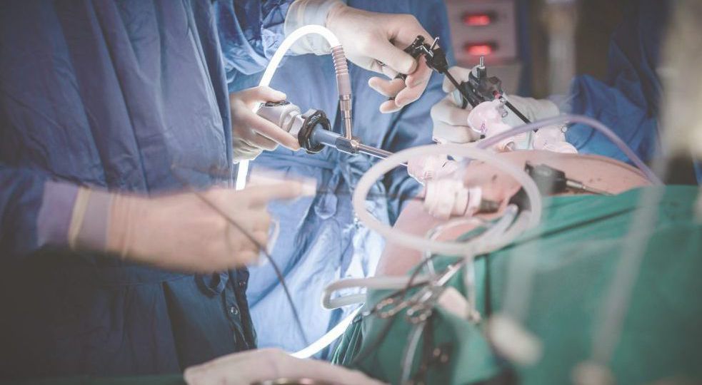 Spleen Surgery head