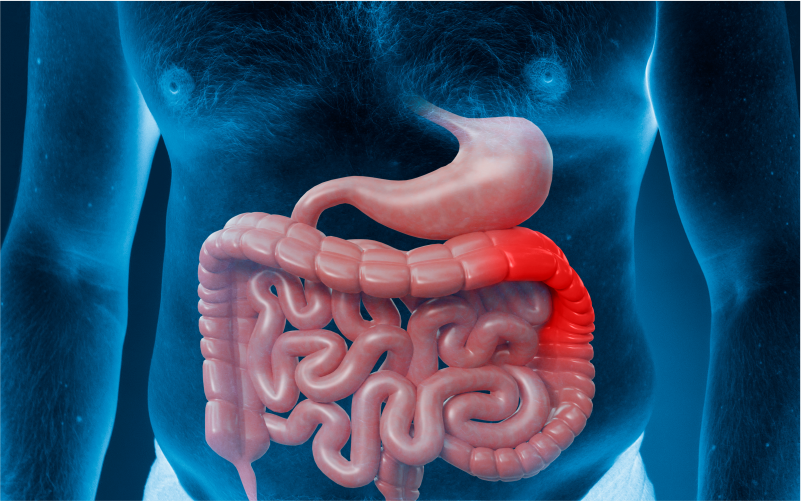 colorectal cancer head 10