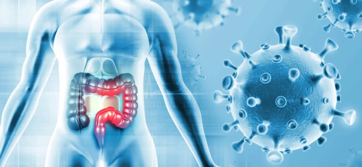 colorectal cancer head 3