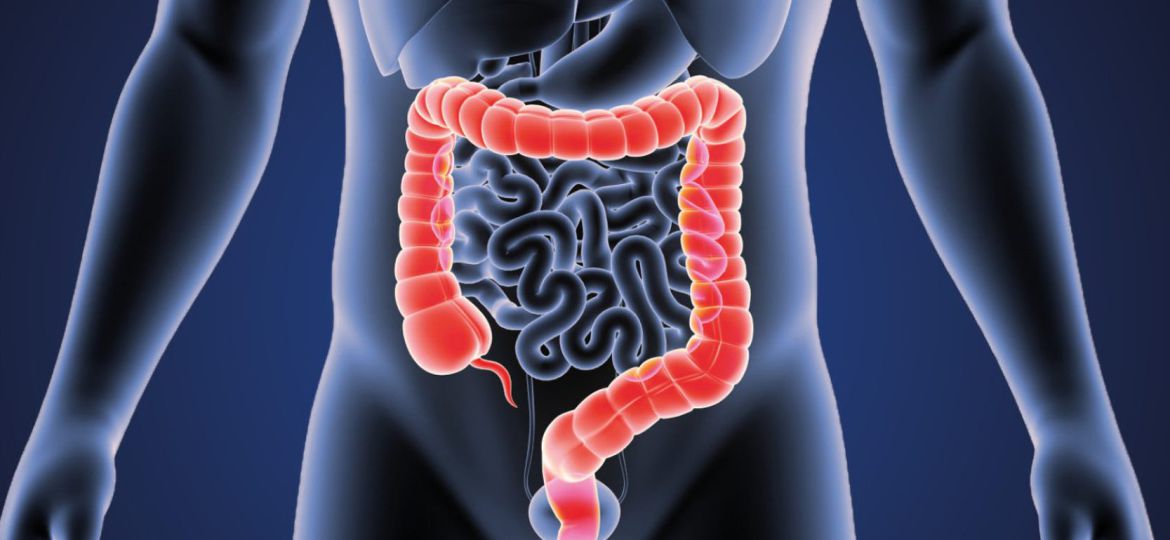 colorectal cancer head 6