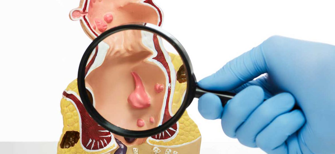 rectum baş