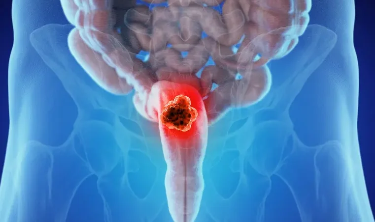 rectum baş2
