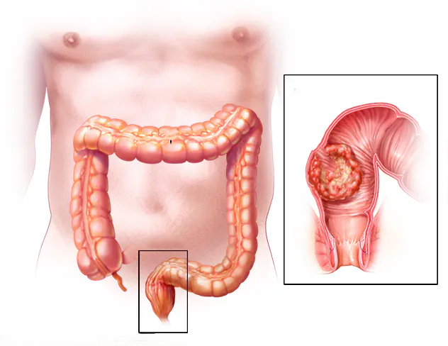 rectum baş33