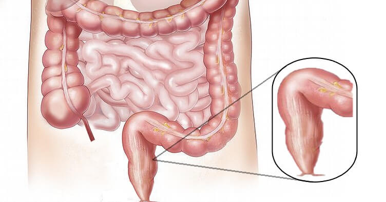 rectum baş6