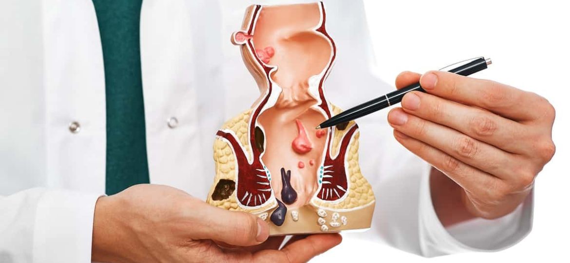 rectum baş9