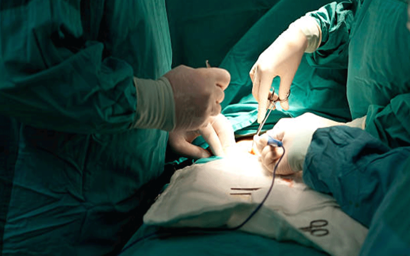 Appendectomy head1