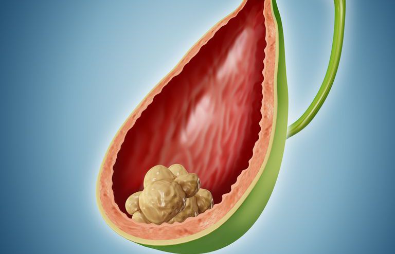 Bile Duct Darlığı head3