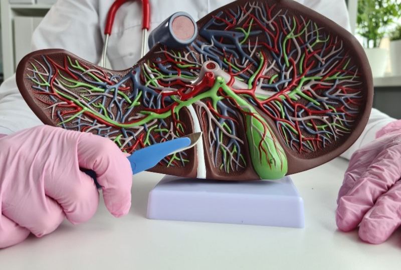 Bile Duct Stenosis HEAD2