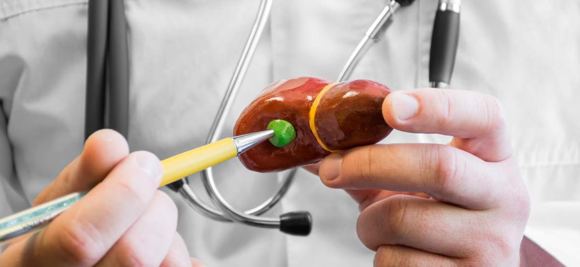 Bile Duct Stenosis HEAD4