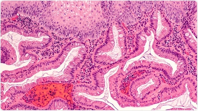 Esophagus head3