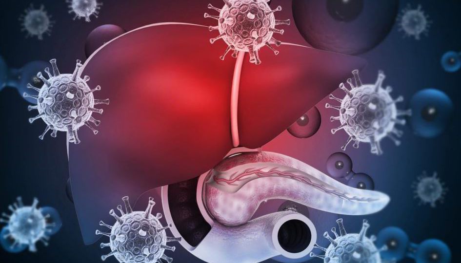 LIVER METASTASES head2