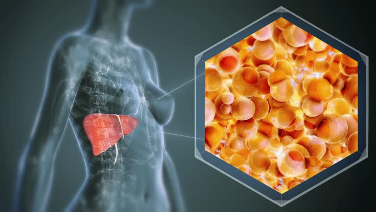 Female Liver anatomy,Fatty liver, Fibrosis, Cirrhosis, and Liver cancer