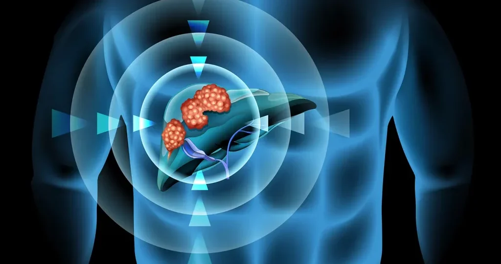 Liver Cancerr head8