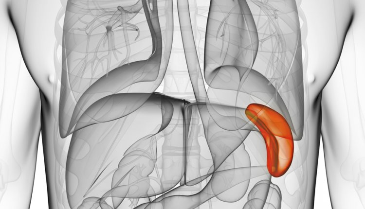 SPLEEN SURGERY H2