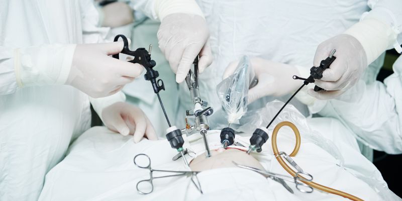 SPLEEN SURGERY H3