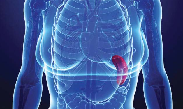 Spleen Surgery 1