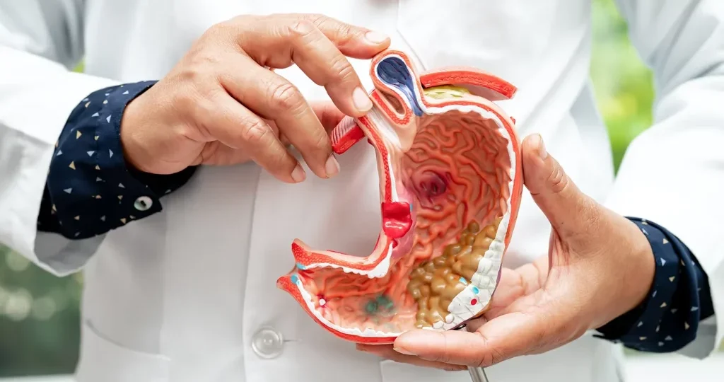 Stomach Cancer head3