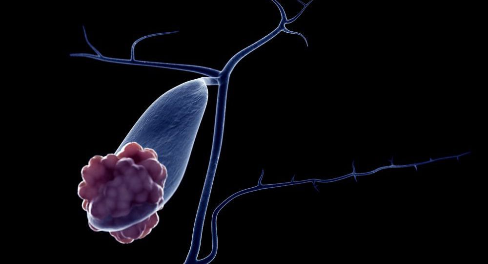 gallbladder cancer head5