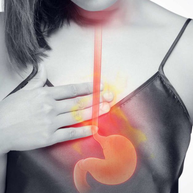 How Do Acidic Beverages Affect Stomach Health Expert Cancer Surgeon